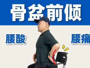 骨盆前倾的最快纠正法（科学锻炼方法帮助您快速改善骨盆前倾问题）