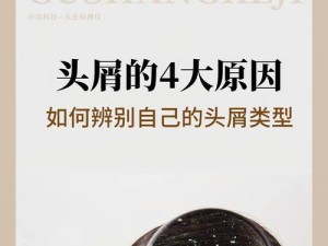 用手机屏幕清理头皮屑,头皮屑的来源与危害
